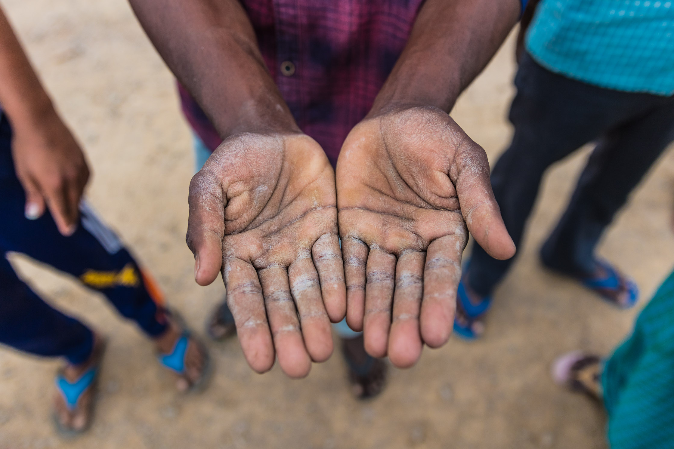 The hands of a stonecutter from Warangal, Telangana. Photo credit: Toby Smith.